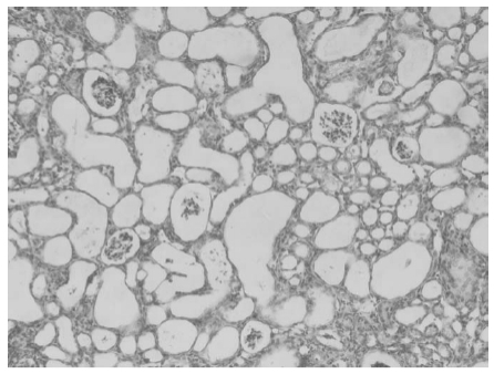 Seria Introducere la impuritățile active de folat: ① Dezvăluirea impactului acidului 5-metiltetrahidropteroic.